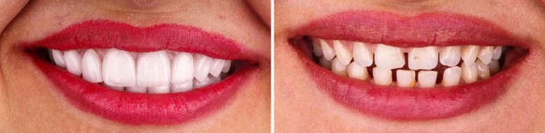 © Adobe Stock #315714974 Garo